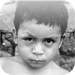 Tropical Diseases